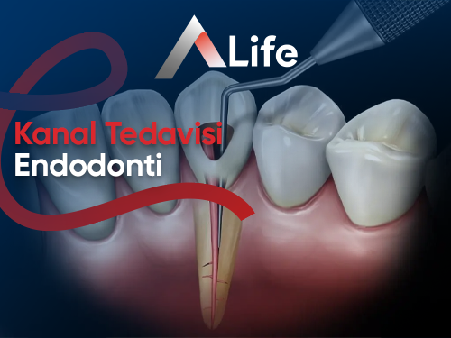 Kanal Tedavisi (Endodonti)